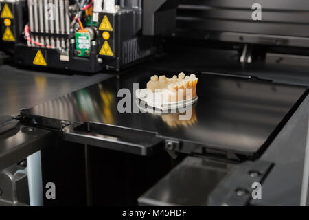 Open 3D Printer With Finished 3D Printed Dental Implant Bridge. Stock Photo