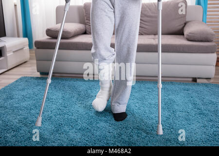 Low Section View Of A Man's Plastered Leg On Blue Carpet Stock Photo