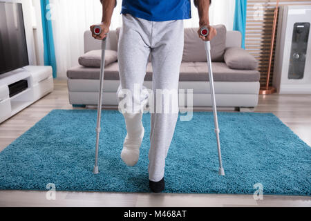 Low Section View Of A Man's Plastered Leg On Blue Carpet Stock Photo