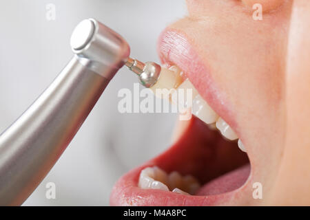 Professional dental cleaning, female patient's beautiful denture Stock Photo