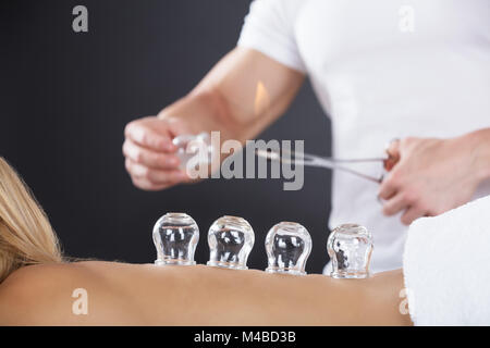 Woman Lying On Front Receiving Cupping Treatment On Back Stock Photo