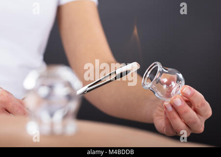 Close-up Of A Therapist Giving Cupping Treatment At Beauty Spa Stock Photo