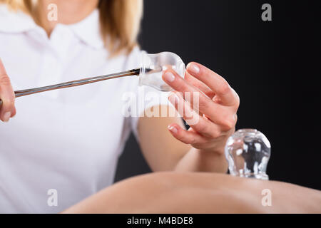 Female Therapist Giving Cupping Treatment On Back At Spa Stock Photo