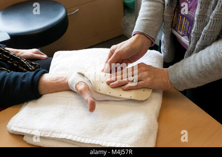 Hand splint made of thermoplastic being custom fitted by an occupational therapist for post-operative Dupuytren's Contracture surgery patient. Stock Photo