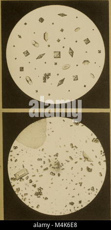 Atlas der physiologischen und pathologischen Harnsedimente (1871) (14594035510) Stock Photo