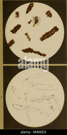 Atlas der physiologischen und pathologischen Harnsedimente (1871) (14594129358) Stock Photo