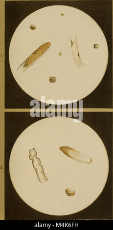 Atlas der physiologischen und pathologischen Harnsedimente (1871) (14777645591) Stock Photo