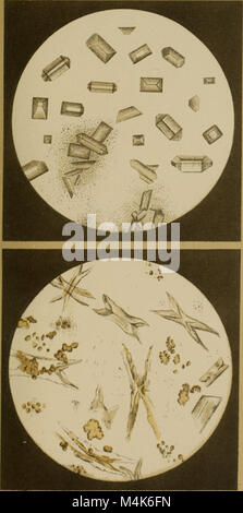 Atlas der physiologischen und pathologischen Harnsedimente (1871) (14778390844) Stock Photo