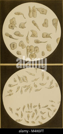 Atlas der physiologischen und pathologischen Harnsedimente (1871) (14778428214) Stock Photo