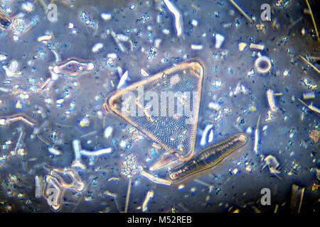 Diatoms, Marine, 100X Stock Photo
