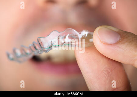 Cropped image of man holding transparent teeth aligners Stock Photo