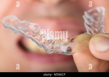 Cropped image of man holding transparent teeth aligners Stock Photo