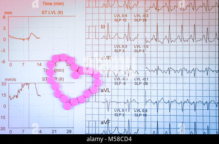 EKG or ECG (Electrocardiogram) graph report paper. EST ( Exercise Stress Test ) result and pink heart shape made from pills. Package promotion for hea Stock Photo