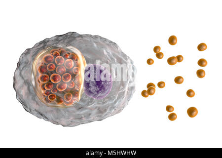Chlamydia psittaci bacteria. Computer illustration showing two life stages of Chlamydia: elementary bodies (extracellular non-multiplying infectious stage, small orange spheres outside the cell) and an inclusion composed of a group of chlamydia reticulate bodies (intracellular multiplying stage, small orange spheres inside the cel) near the nucleus (violet) of a cell. Chlamydia species are atypical bacteria in that they are obligate intracellular parasites, living and reproducing only inside cells. This species causes abortion in animals and lung disease in humans. Stock Photo