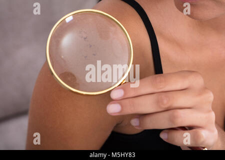 Close-up Of Young Woman Showing Skin On Shoulder Using Magnifying Glass At Home Stock Photo