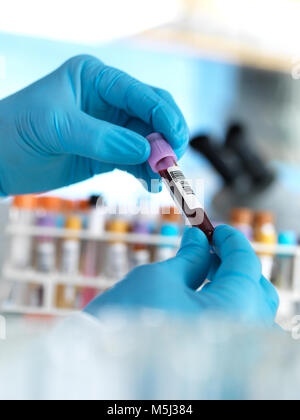 Hand holding blood sample in laboratory Stock Photo