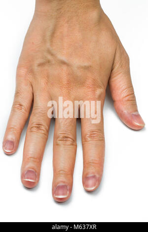 Woman hand with blood veins isolated on white background. Finger with mid-digital hair is dominant gene. Back of hand skin with dry and wrinkle in adu Stock Photo