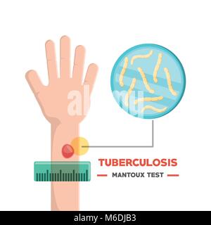 Blood Test Medical Vector Concept Healthcare And Treatment