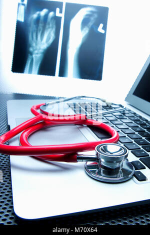 Montreal,Canada,7 March,2018. Stethoscope on a computer laptop.Credit:Mario Beauregard/17�Թ����� Live News Stock Photo
