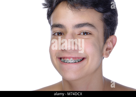 Cute teenager with white background, wearing braces on his teeth. Stock Photo