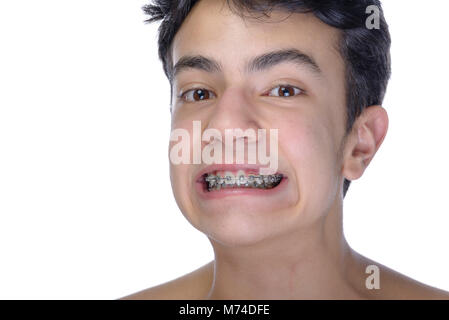 Cute teenager with white background, wearing braces on his teeth. Stock Photo