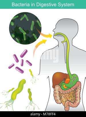 Bacteria in Digestive System. Illustration info graphic. Stock Vector
