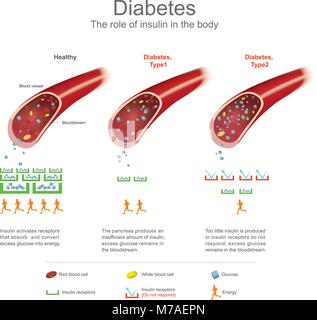 Pancreas respond to high glucose level by secreting insulin. Alpha cell ...