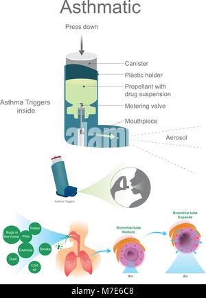 Asthmatic Airway Cells include lung fibroblasts, bronchial epithelial and bronchial smooth muscle cells. Stock Vector