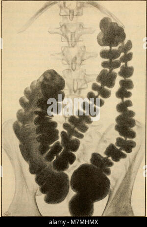 Anatomie médico-chirurgicale de l'abdomen (1922) (14598269658) Stock Photo