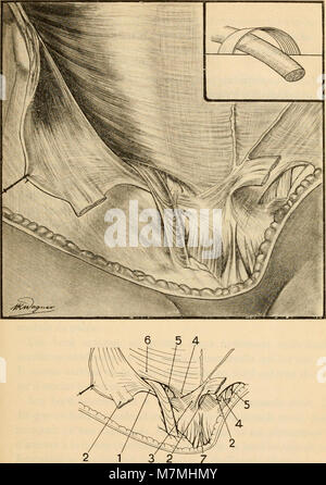 Anatomie médico-chirurgicale de l'abdomen (1922) (14781733071) Stock Photo
