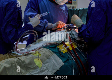 Open heart cardiac bypass surgery in operation room Doctors team wear blue coat perform heart surgery at the operating room Stock Photo