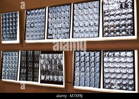 X-ray images of body parts on light wall
