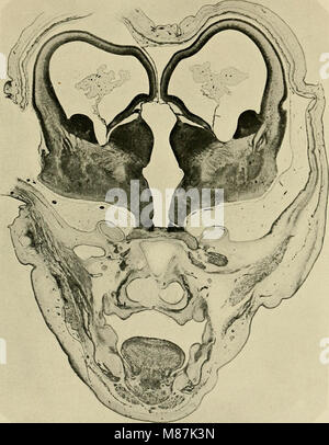 This 1904 study examines the development of the human brain during the ...