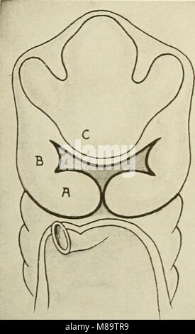 General and dental pathology with special reference to etiology and pathologic anatomy; a treatise for students and practitioners (1920) (14595886660) Stock Photo