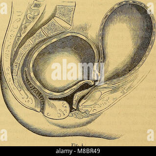 Diagnose, Pathologie und Therapie der Frauen-Krankheiten (1869) (14778308712) Stock Photo