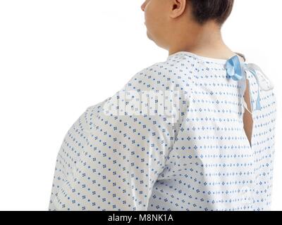 Overweight woman in hospital gown, rear view. Stock Photo