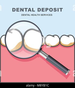 Dental deposit - row of tooth under magnifying glass Stock Vector