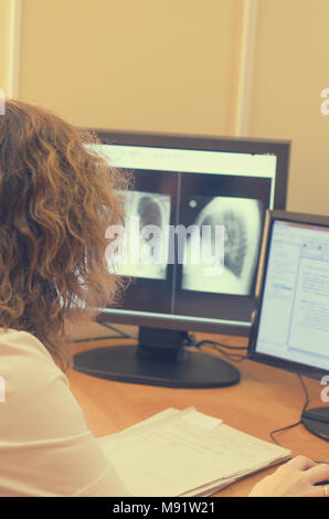 The radiologist looks at the x-ray images on a computer monitor. Stock Photo