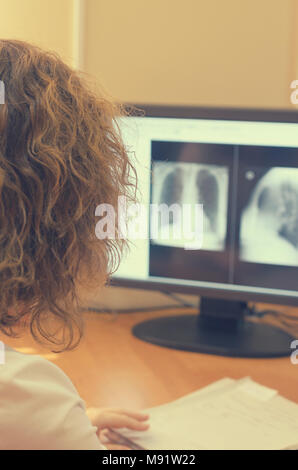 The radiologist looks at the x-ray images on a computer monitor. Stock Photo