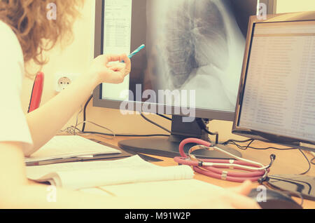 The radiologist looks at the x-ray images on a computer monitor. Stock Photo