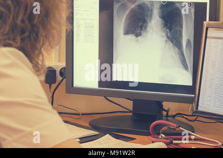 The radiologist looks at the x-ray images on a computer monitor. Stock Photo