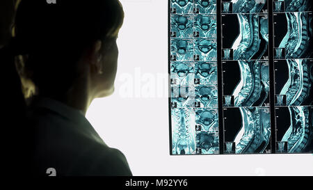 Female doctor looking at roentgen image, patient neck X-ray, diagnosing patient Stock Photo