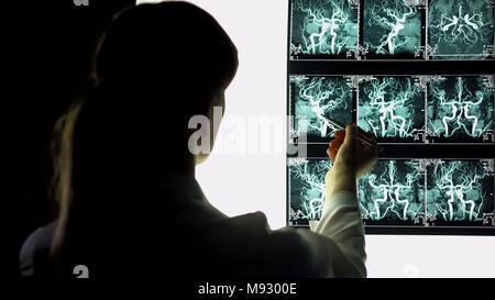 Neurosurgeon examining blood vessels x-ray, making diagnosis, patient treatment Stock Photo