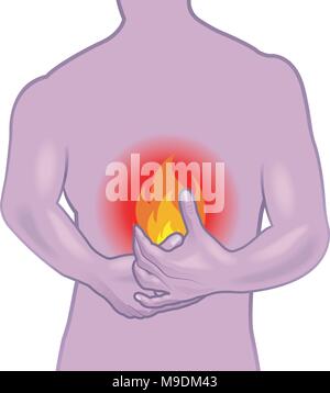 symbolic medical illustration showing the symptoms of the burning stomach Stock Vector