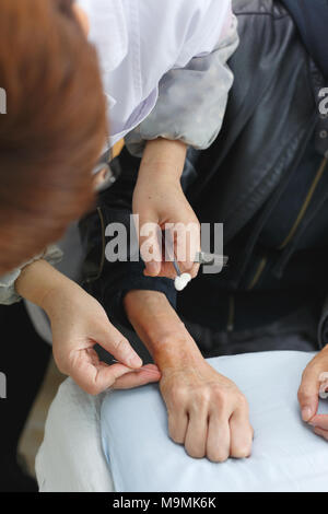 Acupuncture scene at a clinic in China Stock Photo - Alamy