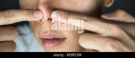 Squeezing acne on nose close up Stock Photo