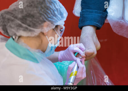 Professional hardware pedicure using electric machine.Patient on medical pedicure procedure. Stock Photo