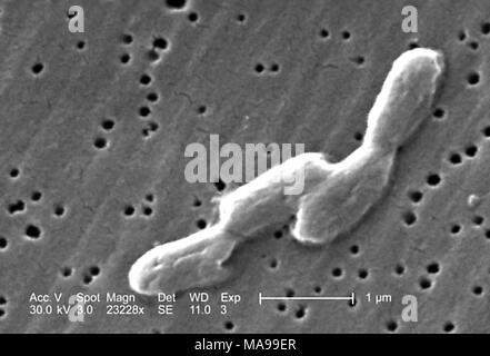 Four rod-shaped Gram-negative Salmonella infantis bacteria revealed in the scanning electron microscopic (SEM) image, 2005. Image courtesy Centers for Disease Control (CDC) / Janice Haney Carr. () Stock Photo