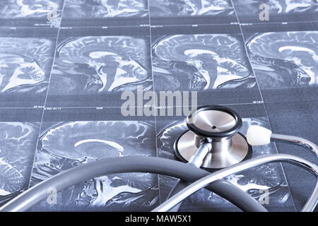 Perspective view of MRI scan of the human brain (sagittal view) and a stethoscope Stock Photo