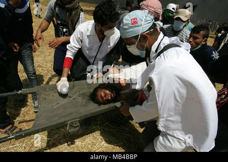 Gaza, Palestine. 6th Apr, 2018. Wounded tended to during clashes with Israeli security forces during clashes on the Gaza-Israel border following a protest, east of Khan Yunis, in the southern Gaza Strip on April 6, 2018. Clashes erupted on the Gaza-Israel border a week after similar demonstrations led to violence in which Israeli force killed 19 Palestinians, the bloodiest day since a 2014 war. Credit: Awakening Photo Agency/Alamy Live News Stock Photo